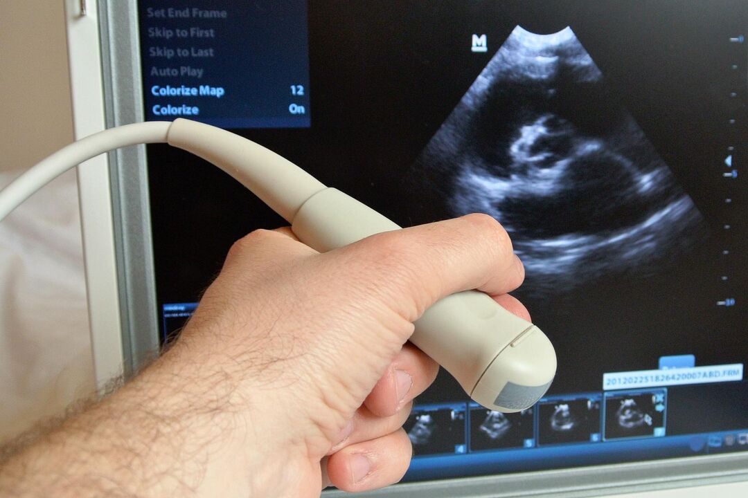 L'échographie aidera à diagnostiquer la prostatite congestive chez un homme